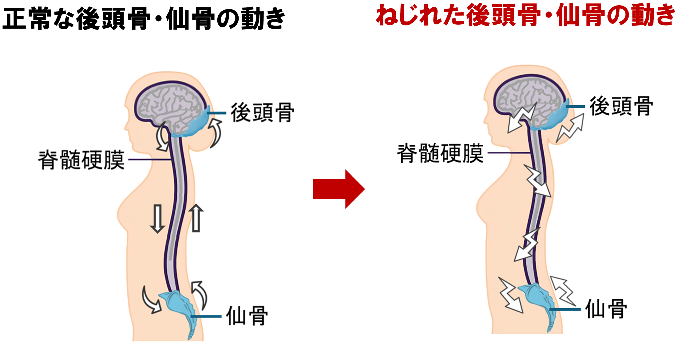 後頭骨・仙骨