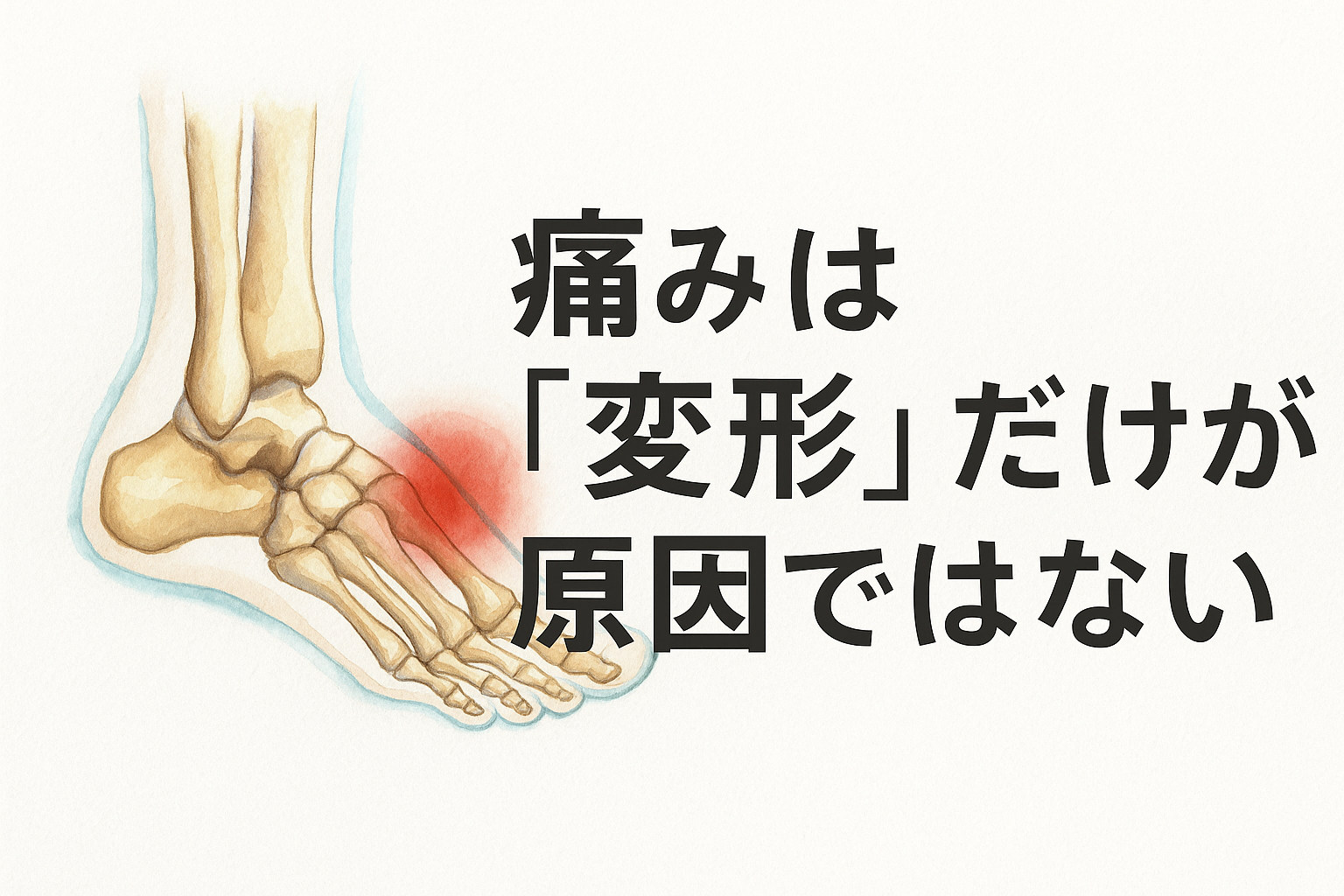 外反母趾