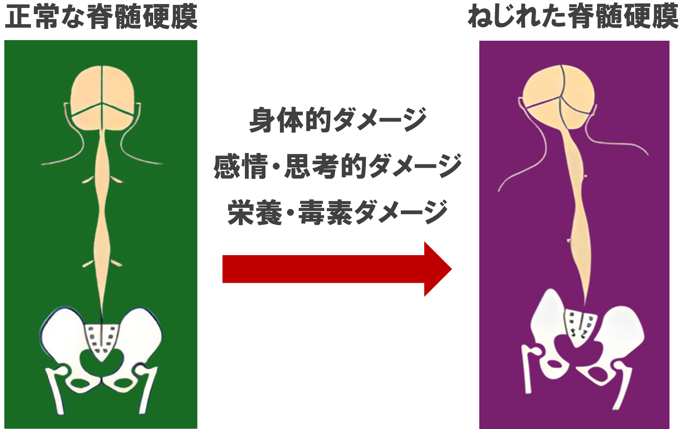 脊髄硬膜