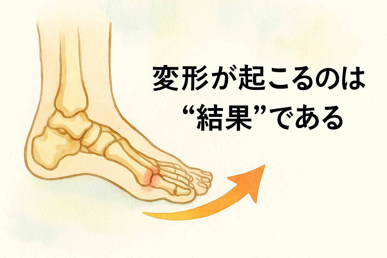 外反母趾