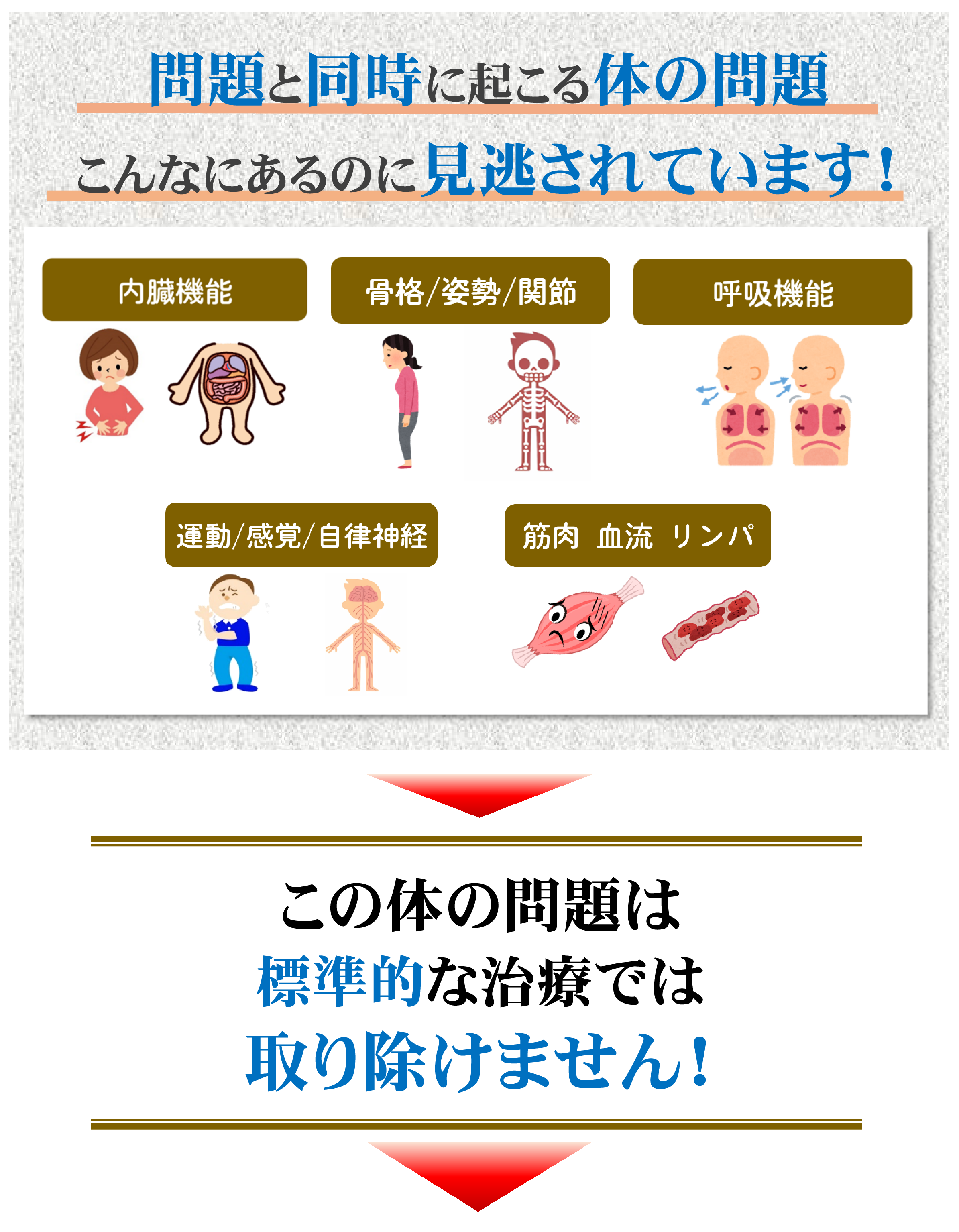 腰椎分離・すべり症